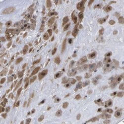 Invitrogen FAM110B Polyclonal Antibody 100 &mu;L; Unconjugated:Antibodies,