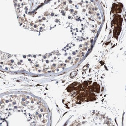Invitrogen TMEM109 Polyclonal Antibody 100 &mu;L; Unconjugated:Antibodies,