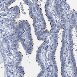 Invitrogen WBP5 Polyclonal Antibody 100 &mu;L | Buy Online | Invitrogen&trade; | Fisher Scientific