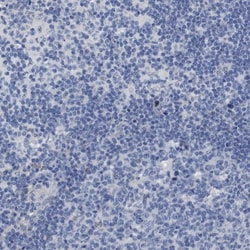 Invitrogen WBP5 Polyclonal Antibody 100 &mu;L | Buy Online | Invitrogen&trade; | Fisher Scientific