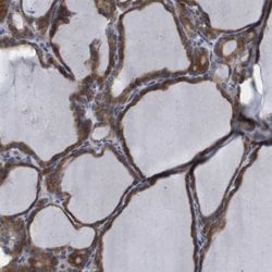 Invitrogen WBP5 Polyclonal Antibody 100 &mu;L | Buy Online | Invitrogen&trade; | Fisher Scientific