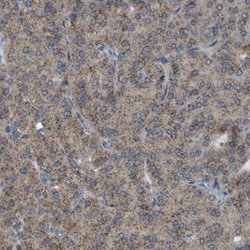 Invitrogen ACBD5 Polyclonal Antibody 100 &mu;L; Unconjugated:Antibodies,