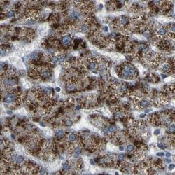 Invitrogen ACBD5 Polyclonal Antibody 100 &mu;L; Unconjugated:Antibodies,