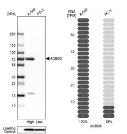 Invitrogen ACBD5 Polyclonal Antibody 100 &mu;L; Unconjugated:Antibodies,