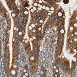 Invitrogen PCDH7 Polyclonal Antibody 100 &mu;L; Unconjugated:Antibodies,