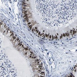 Invitrogen Cullin 4B Polyclonal Antibody 100 &mu;L; Unconjugated:Antibodies,