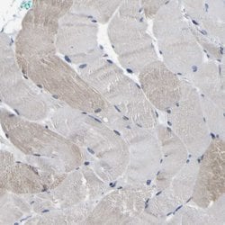 Invitrogen Cullin 4B Polyclonal Antibody 100 &mu;L; Unconjugated:Antibodies,