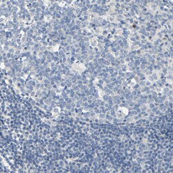 Invitrogen NEGR1 Polyclonal Antibody 100 &mu;L | Buy Online | Invitrogen&trade; | Fisher Scientific