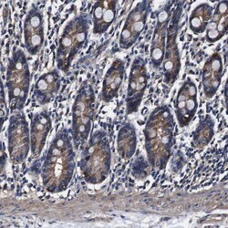 Invitrogen Alix Polyclonal Antibody 100 &mu;L; Unconjugated:Antibodies,