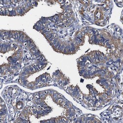 Invitrogen Alix Polyclonal Antibody 100 &mu;L; Unconjugated:Antibodies,