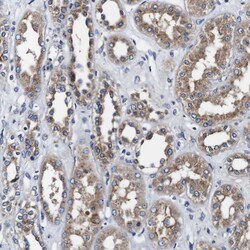 Invitrogen Alix Polyclonal Antibody 100 &mu;L; Unconjugated:Antibodies,