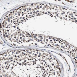 Invitrogen Alix Polyclonal Antibody 100 &mu;L; Unconjugated:Antibodies,