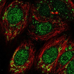 Invitrogen DHODH Polyclonal Antibody 100 &mu;L; Unconjugated:Antibodies,
