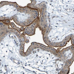 Invitrogen DHODH Polyclonal Antibody 100 &mu;L; Unconjugated:Antibodies,