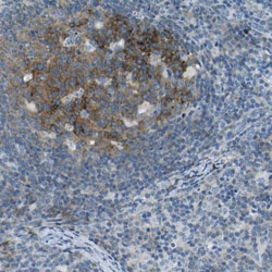 Invitrogen SorCS1 Polyclonal Antibody 100 &mu;L; Unconjugated:Antibodies,