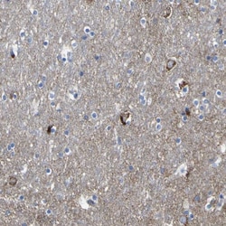 Invitrogen HKDC1 Polyclonal Antibody 100 &mu;L; Unconjugated:Antibodies,