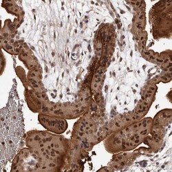 Invitrogen PRR12 Polyclonal Antibody 100 &mu;L; Unconjugated:Antibodies,