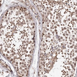 Invitrogen PRR12 Polyclonal Antibody 100 &mu;L; Unconjugated:Antibodies,