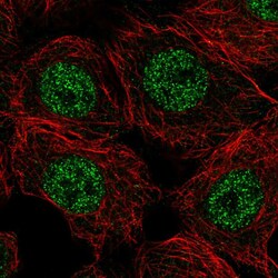 Invitrogen Calpain 15 Polyclonal Antibody 100 &mu;L; Unconjugated:Antibodies,