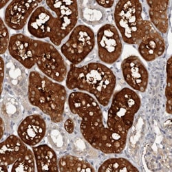 Invitrogen Calpain 15 Polyclonal Antibody 100 &mu;L; Unconjugated:Antibodies,