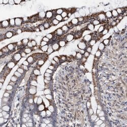 Invitrogen Monoacylglycerol Lipase Polyclonal Antibody 100 &mu;L; Unconjugated:Antibodies,