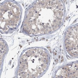 Invitrogen Monoacylglycerol Lipase Polyclonal Antibody 100 &mu;L; Unconjugated:Antibodies,