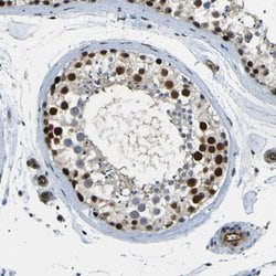 Invitrogen PARN Polyclonal Antibody 100 &mu;L; Unconjugated:Antibodies,