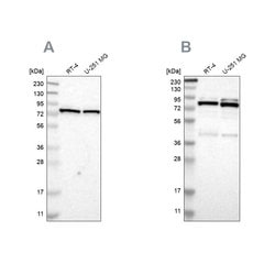 Invitrogen PARN Polyclonal Antibody 100 &mu;L; Unconjugated:Antibodies,