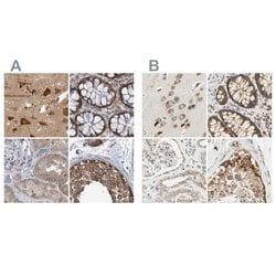 Invitrogen LRRC47 Polyclonal Antibody 100 &mu;L; Unconjugated:Antibodies,
