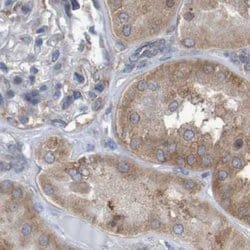 Invitrogen LRRC47 Polyclonal Antibody 100 &mu;L; Unconjugated:Antibodies,