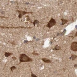 Invitrogen LRRC47 Polyclonal Antibody 100 &mu;L; Unconjugated:Antibodies,