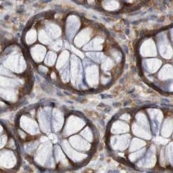 Invitrogen LRRC47 Polyclonal Antibody 100 &mu;L; Unconjugated:Antibodies,