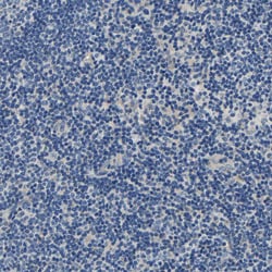 Invitrogen Centaurin alpha-1 Polyclonal Antibody 100 &mu;L; Unconjugated:Antibodies,