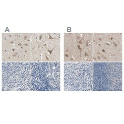 Invitrogen Centaurin alpha-1 Polyclonal Antibody 100 &mu;L; Unconjugated:Antibodies,