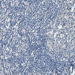 Invitrogen Centaurin alpha-1 Polyclonal Antibody 100 &mu;L; Unconjugated:Antibodies,