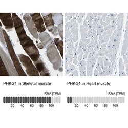 Invitrogen PHKG1 Polyclonal Antibody 100 &mu;L; Unconjugated:Antibodies,