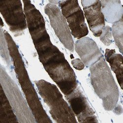 Invitrogen PHKG1 Polyclonal Antibody 100 &mu;L; Unconjugated:Antibodies,