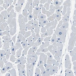 Invitrogen PHKG1 Polyclonal Antibody 100 &mu;L; Unconjugated:Antibodies,