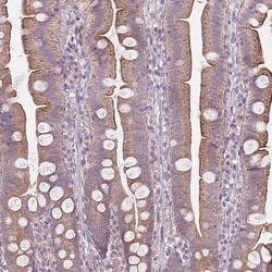 Invitrogen SGK223 Polyclonal Antibody 100 &mu;L; Unconjugated:Antibodies,