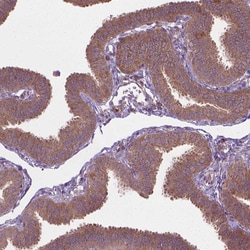 Invitrogen SGK223 Polyclonal Antibody 100 &mu;L; Unconjugated:Antibodies,