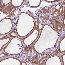 Invitrogen SGK223 Polyclonal Antibody 100 &mu;L; Unconjugated:Antibodies,