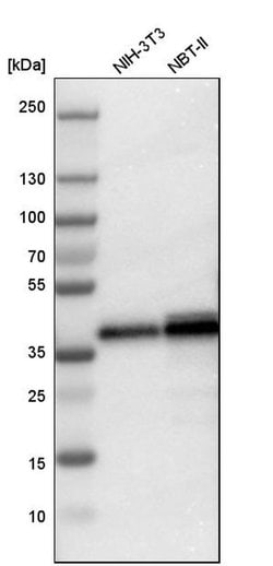 Invitrogen LASP1 Polyclonal Antibody 100 &mu;L | Buy Online | Invitrogen&trade; | Fisher Scientific