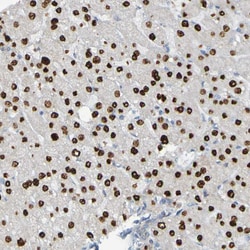 Invitrogen USP36 Polyclonal Antibody 100 &mu;L | Buy Online | Invitrogen&trade; | Fisher Scientific