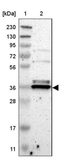 Invitrogen TMBIM1 Polyclonal Antibody 100 &mu;L; Unconjugated:Antikörper