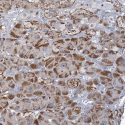 Invitrogen C3orf18 Polyclonal Antibody 100 &mu;L; Unconjugated:Antibodies,