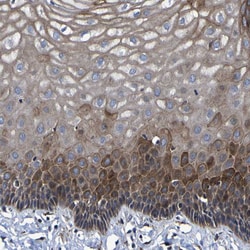 Invitrogen LEPRE1 Polyclonal Antibody 100 &mu;L; Unconjugated:Antibodies,