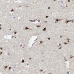 Invitrogen JHDM1D Polyclonal Antibody 100 &mu;L; Unconjugated:Antibodies,