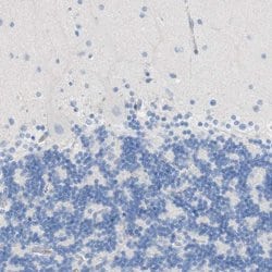 Invitrogen FCGRT Polyclonal Antibody 100 &mu;L; Unconjugated:Antibodies,