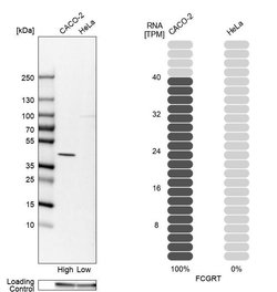 Invitrogen FCGRT Polyclonal Antibody 100 &mu;L; Unconjugated:Antibodies,