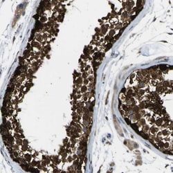 Invitrogen C11orf48 Polyclonal Antibody 100 &mu;L; Unconjugated:Antibodies,